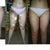 Liposuction Community Photo